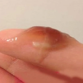 Khí Hư Màu Nâu Đen Là Bị Gì? Nguyên Nhân Và Khi Nào Cần Đi Khám