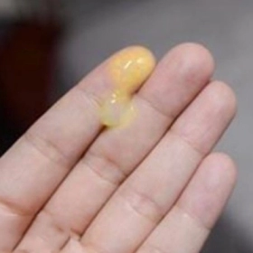 Khí Hư Màu Vàng Là Bị Gì? Nguyên Nhân Và Khi Nào Cần Đi Khám