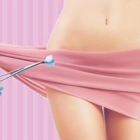 Lạc Nội Mạc Ở Âm Hộ Là Gì? Nguyên Nhân, Triệu Chứng Và Cách Điều Trị