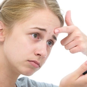 Làm Sao Để Hết Mụn Tuổi Dậy Thì? Truy Tìm Giải Pháp