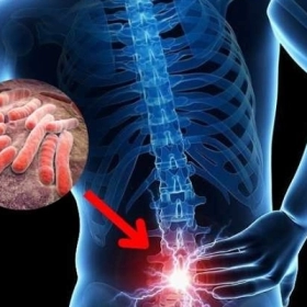 Lao Cột Sống: Nguyên Nhân, Triệu Chứng, Điều Trị Và Cách Phòng Ngừa Hiệu Quả