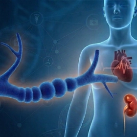 Loạn Sản Sợi Cơ: Nguyên Nhân, Triệu Chứng Và Cách Điều Trị