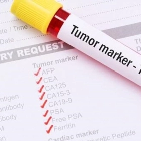 Marker Ung Thư Là Gì? Có Giúp Phát Hiện Chính Xác Bệnh Không?