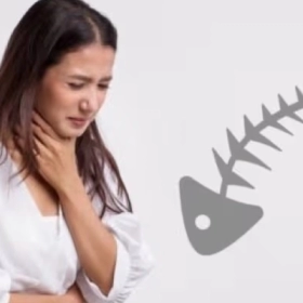 Mẹo Chữa Hóc Xương Cá Cho Trẻ Em Và Người Lớn