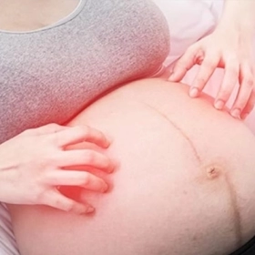 Mẹo Dân Gian Trị Ngứa Cho Bà Bầu: An Toàn, Hiệu Quả Mà Không Cần Dùng Thuốc