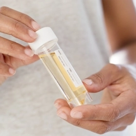 Microalbumin Niệu Là Gì? Nguyên Nhân, Triệu Chứng Và Cách Xử Trí