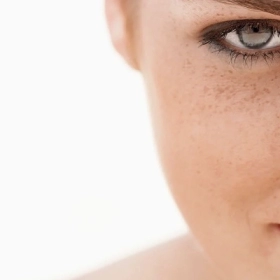 Nám Chân Đinh Là Gì? Nguyên Nhân Và Cách Điều Trị Hiệu Quả