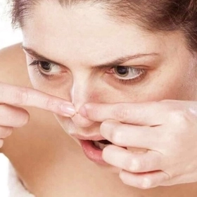 Nặn Mụn Đúng Cách: Hướng Dẫn An Toàn Giúp Tránh Thâm Và Sẹo Nặn Mụn Đúng Cách: Hướng Dẫn An Toàn Giúp Tránh Thâm Và Sẹo