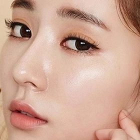 Nâng Mũi Bao Lâu Thì Đầu Mũi Hết To? Thời Gian Gom Form Mũi