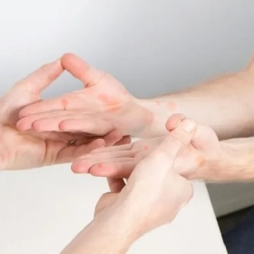 Nguyên Nhân Gây Mụn Nước Ở Tay Và Cách Xử Lý Hiệu Quả Tại Nhà