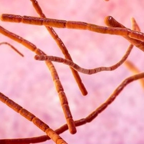 Nhiễm Nocardia Là Gì? Nguyên Nhân, Triệu Chứng Và Cách Điều Trị