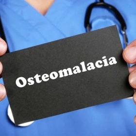 Nhuyễn Xương: Dấu Hiệu, Nguyên Nhân Và Cách Điều Trị Hiệu Quả