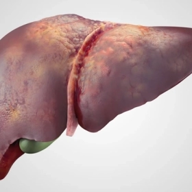 Phát Hiện Nốt Vôi Hóa Gan Có Đáng Lo Ngại Không?