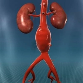 Phình Động Mạch Chủ Bụng Là Gì? Nguyên Nhân, Triệu Chứng Và Cách Điều Trị Hiệu Quả