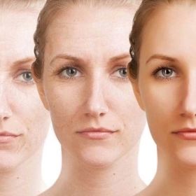 Resveratrol Là Gì? Công Dụng Và Cách Dùng Cho Làn Da