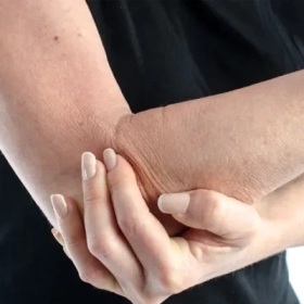 Rối loạn dây thần kinh trụ là gì? Dấu hiệu, nguyên nhân và điều trị