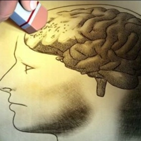 Sa Sút Trí Tuệ Thể Lewy: Dấu Hiệu Nhận Biết Sớm, Nguyên Nhân Và Điều Trị Sa Sút Trí Tuệ Thể Lewy: Dấu Hiệu Nhận Biết Sớm, Nguyên Nhân Và Điều Trị