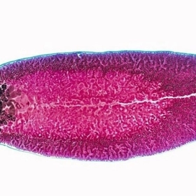 Sán Lá Gan Là Gì? Nguyên Nhân, Triệu Chứng Và Cách Điều Trị Hiệu Quả