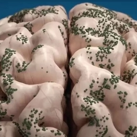 Sán não: Nguyên nhân, triệu chứng và cách điều trị hiệu quả