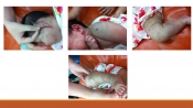 Sốc phản vệ Sốc phản vệ