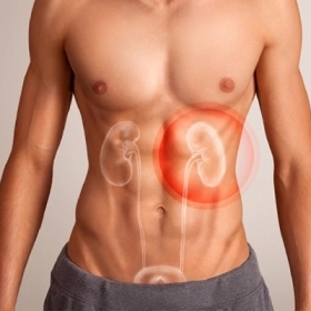 Sỏi Thận Là Gì? Nguyên Nhân, Triệu Chứng Và Cách Điều Trị Hiệu Quả