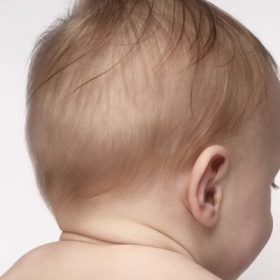 Tại Sao Trẻ Sơ Sinh Hay Bị Rụng Tóc Vành Khăn? Có Nguy Hiểm Không?