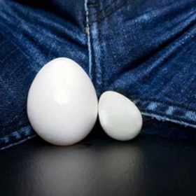 Teo Tinh Hoàn Là Gì? Nguyên Nhân, Dấu Hiệu Và Cách Điều Trị Hiệu Quả