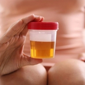 Thiểu Niệu Là Gì? Nguyên Nhân Gây Ra Triệu Chứng Tiểu Ít Và Cách Xử Trí Đúng