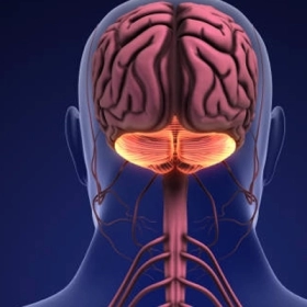 Thoái hóa tiểu não: Nguyên nhân, triệu chứng và cách điều trị