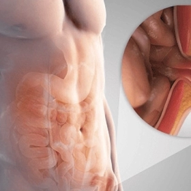 Thoát Vị Đùi: Nguyên Nhân, Dấu hiệu Và Phương Pháp Điều Trị