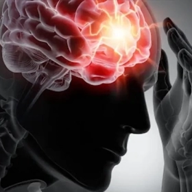 Thoát vị não: Triệu chứng cấp cứu, nguyên nhân và cách xử trí