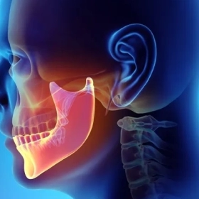 Tiêu xương hàm Là Gì? Nguyên Nhân, Dấu Hiệu Và Cách Điều Trị
