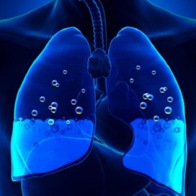 Tràn Khí Màng Phổi Là Gì? Nguyên Nhân, Triệu Chứng Và Cách Điều Trị