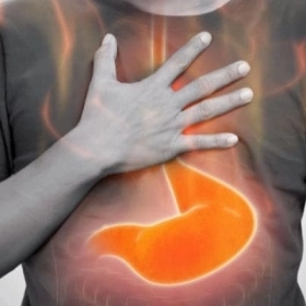 Trào Ngược Dạ Dày Kiêng Ăn Gì? Hướng Dẫn Ăn Uống Giúp Kiểm Soát Triệu Chứng