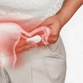 Ứ Dịch Vòi Trứng Là Gì? Nguyên Nhân, Triệu Chứng Và Cách Điều Trị