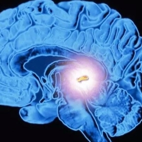 U tuyến tùng là gì? Dấu hiệu, nguyên nhân và cách điều trị