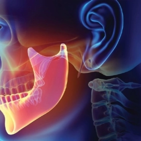 U Xương Hàm: Dấu Hiệu, Nguyên Nhân Và Cách Điều Trị