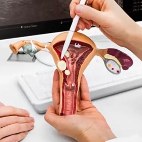 Ung Thư Âm Đạo Là Gì? Nguyên Nhân, Triệu Chứng Và Cách Điều Trị