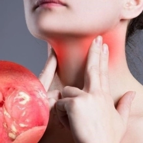 Ung Thư Amidan Khẩu Cái: Dấu Hiệu Nhận Biết Sớm Và Tiên Lượng Bệnh