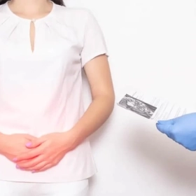 Ung Thư Tá Tràng Là Gì? Nguyên Nhân, Triệu Chứng Và Cách Điều Trị