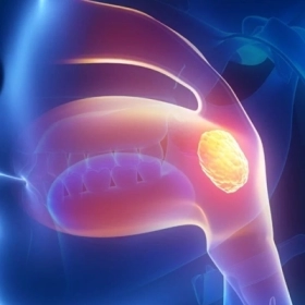 Ung Thư Vòm Họng Có Chữa Được Không? Sống Được Bao Lâu?