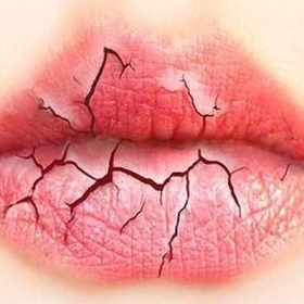 Uống nhiều nước nhưng vẫn khô miệng: Nguyên nhân Và Cách Khắc Phục