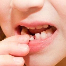 Vì Sao Răng Lung Lay? Những Nguyên Nhân Thường Gặp