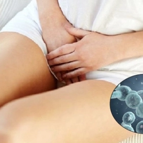 Viêm Âm Đạo Do Nấm Candida: Dấu Hiệu Và Cách Điều Trị