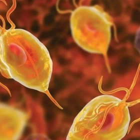 Viêm Âm Đạo Do Trùng Roi Trichomonas: Dấu Hiệu Và Hướng Xử Trí