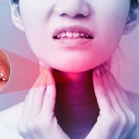 Viêm Amidan Xơ Teo Là Gì? Nguyên Nhân, Triệu Chứng Và Cách Điều Trị