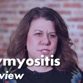 Viêm Đa Cơ: Nguyên Nhân, Triệu Chứng Và Cách Điều Trị