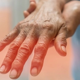 Viêm đa dây thần kinh: Nguyên nhân, triệu chứng và cách điều trị