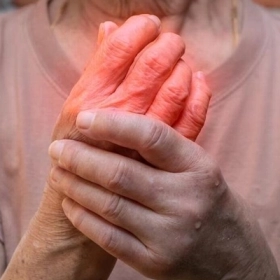 Viêm Đa Khớp: Nguyên Nhân, Triệu chứng Và Điều Trị (2026)