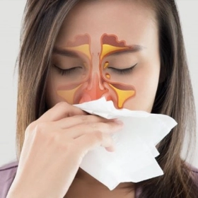 Viêm Đa Xoang Là Gì? Nguyên Nhân, Triệu Chứng Và Cách Điều Trị